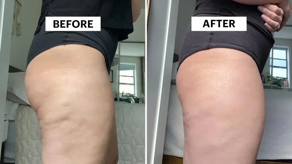 Do Toning Exercise Portsmouth  Really Tackle Cellulite?
