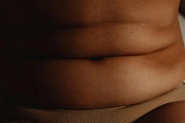 image of what stress can do on the stomach area and how Lipo 360 Portsmouth  can help to change your body shape.
